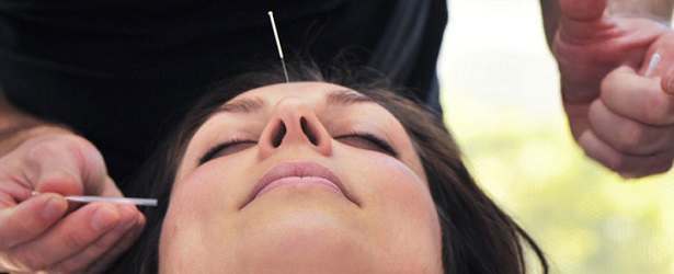 Treating Insomnia With Acupuncture